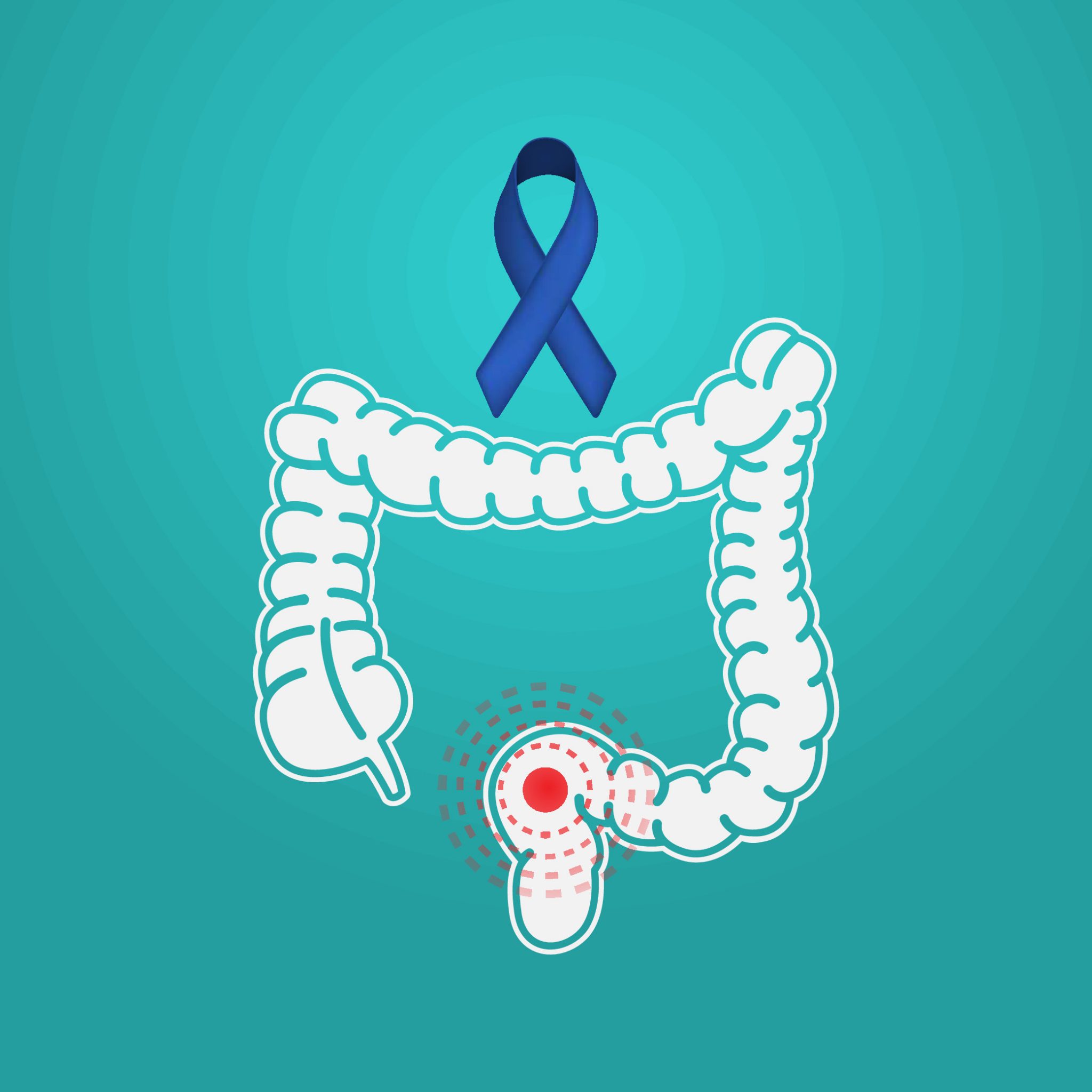 Colon Cancer: Knowing Your Risks and How to Cope