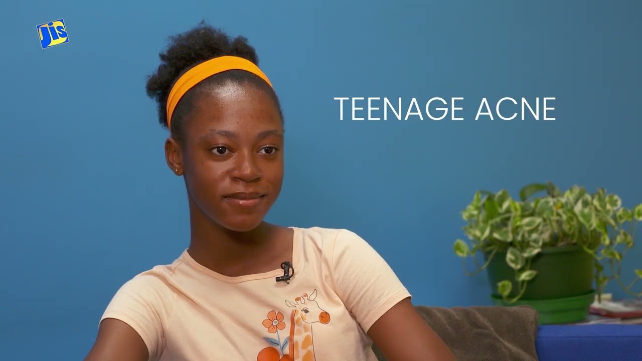 Understanding Acne – Finding Confidence