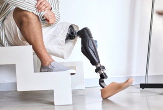 Close up of male amputee with prosthetic leg on above knee. 